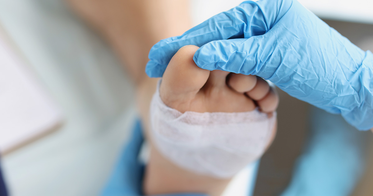 Wound Care and Dressings at Home